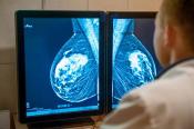 Doctor viewing mammography image on screen.