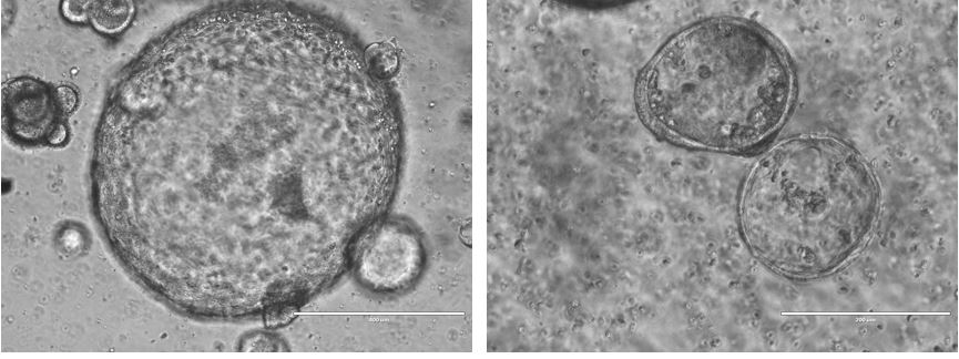 Organoids generated from mismatch repair-deficient mouse intestinal tumors.