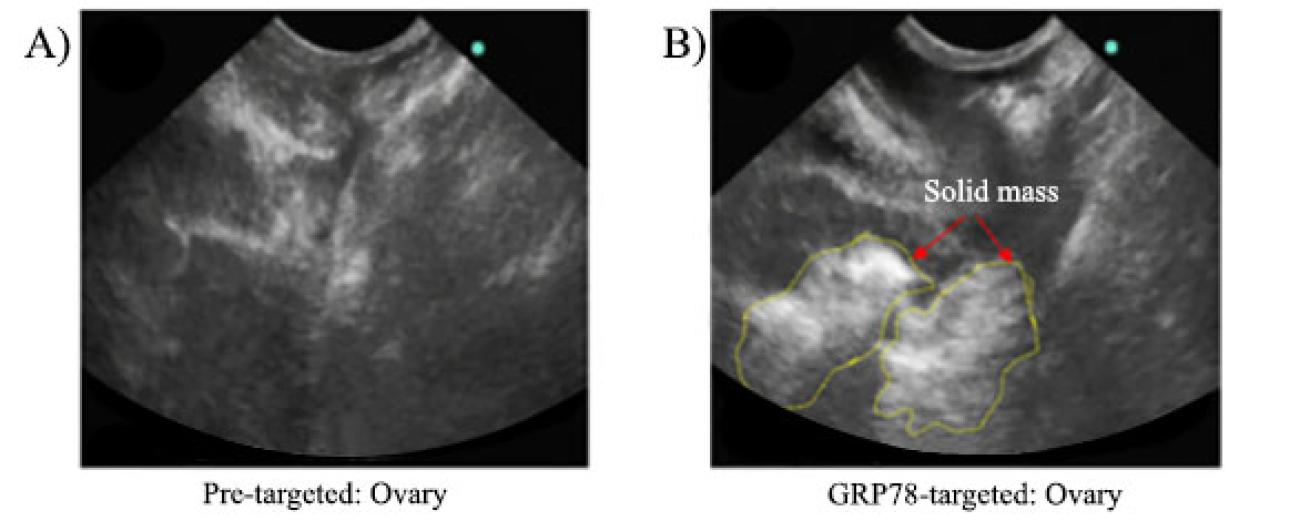 Left Image: A.) Ultrasound of Pre-targeted: Ovary. Right Image: Ultrasound of GRP78-targted: Ovary with two red arrows pointing at highlighted portion of ultrasound where solid masses are present