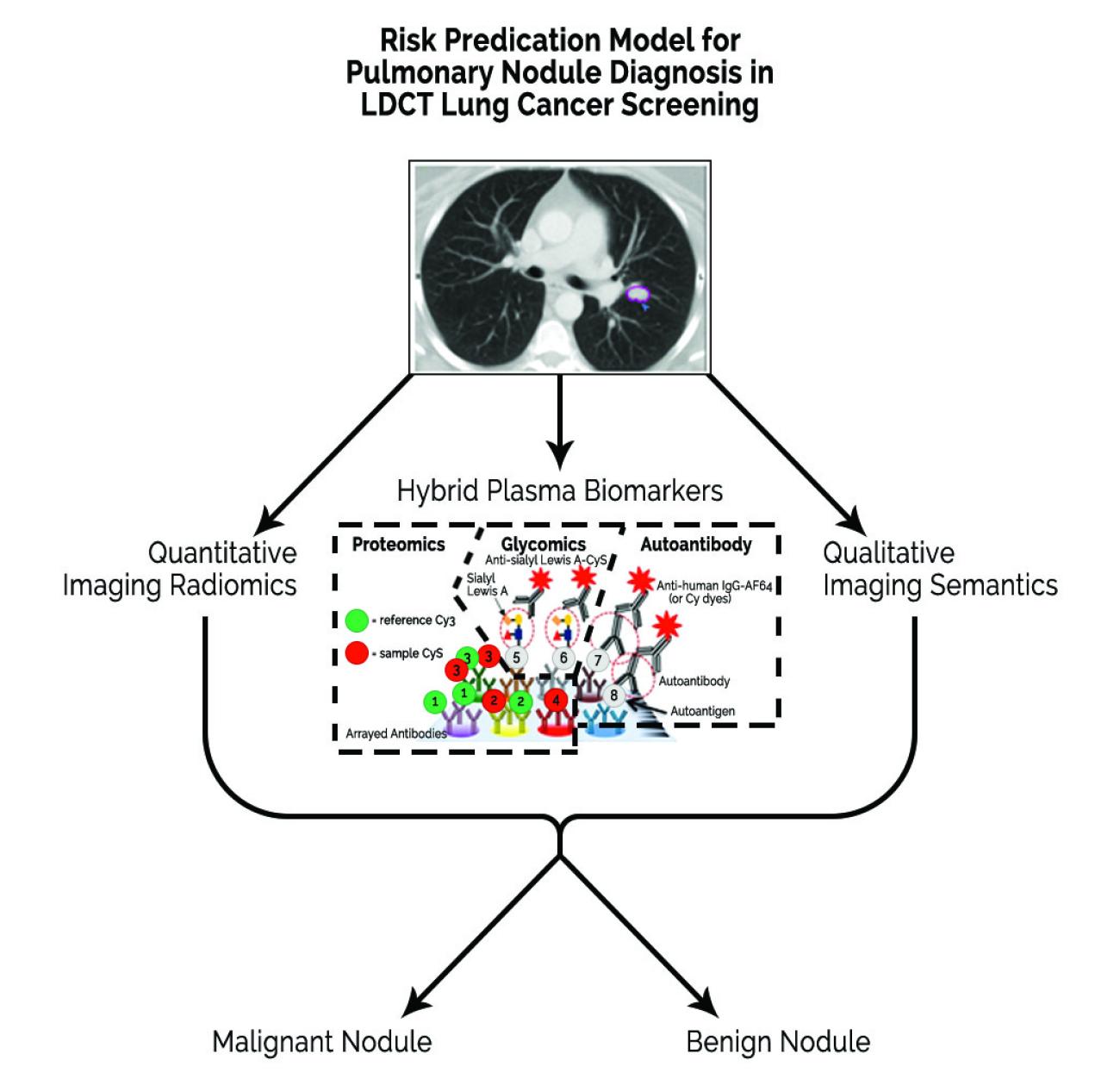 Risk Predication Model for Pulmonary Nodule Diagnosis in LDCT Lung Cancer Screening Chart with a footnote below describing the graphic