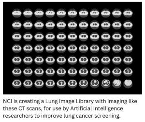 How Accurate Is a CT Scan for Lung Cancer?