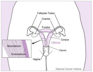 The uterus and nearby organs in the female reproductive tract (ovaries, fallopian tubes, cervix, and vagina). An inset provides a close-up view of the layers of the tissue in the uterus (myometrium and endometrium).