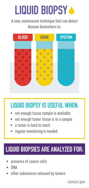 Study Examines Whether Blood Test Can Identify Early Cancers - NCI