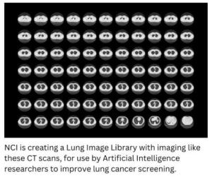 NCI is creating a Lung Image Library with imaging like these CT scans, for use by Artificial Intelligence researchers to improve lung cancer screening