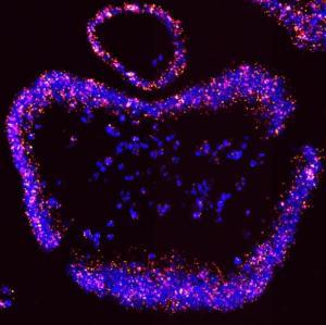 Wildtype and frameshift mutant Asxl1 mRNA detected by in situ hybridization using RNAScope technology in organoids derived from a mismatch repair-deficient mouse intestinal tumor.