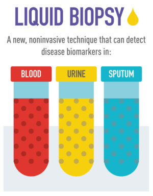 Liquid Biopsy: A new, noninvasive technique that can detect disease biomarkers in blood, urine, and sputum.