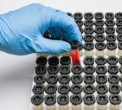 A gloved hand lifting a test tube of a blood sample from a rack.