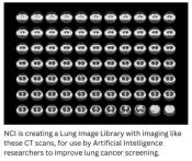 NCI is creating a Lung Image Library with imaging like these CT scans, for use by Artificial Intelligence researchers to improve lung cancer screening