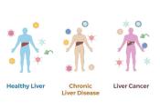 Virus particles surround three human figures with their livers highlighted. One figure has a healthy liver, one has chronic liver disease and one has liver cancer.